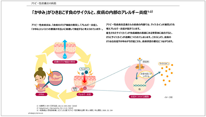 図5　アトピー性皮膚炎の病態<
